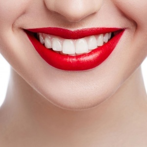 L’orthodontie CFast